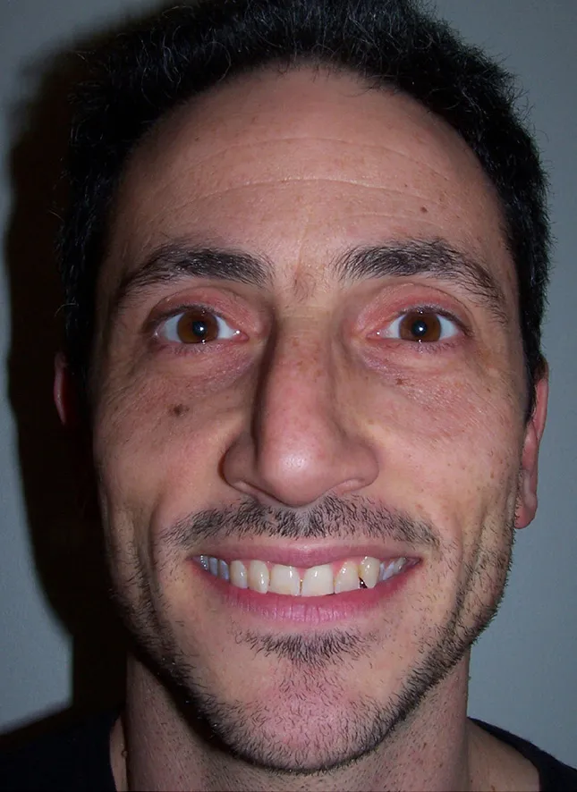 before and after treatment