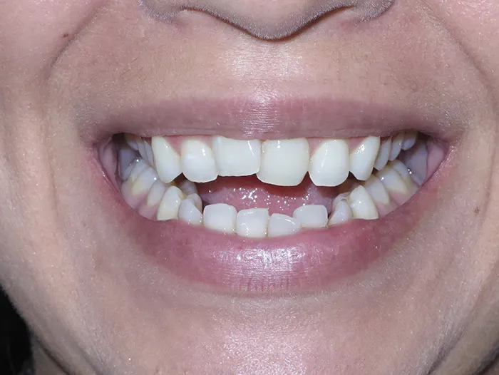 before and after treatment