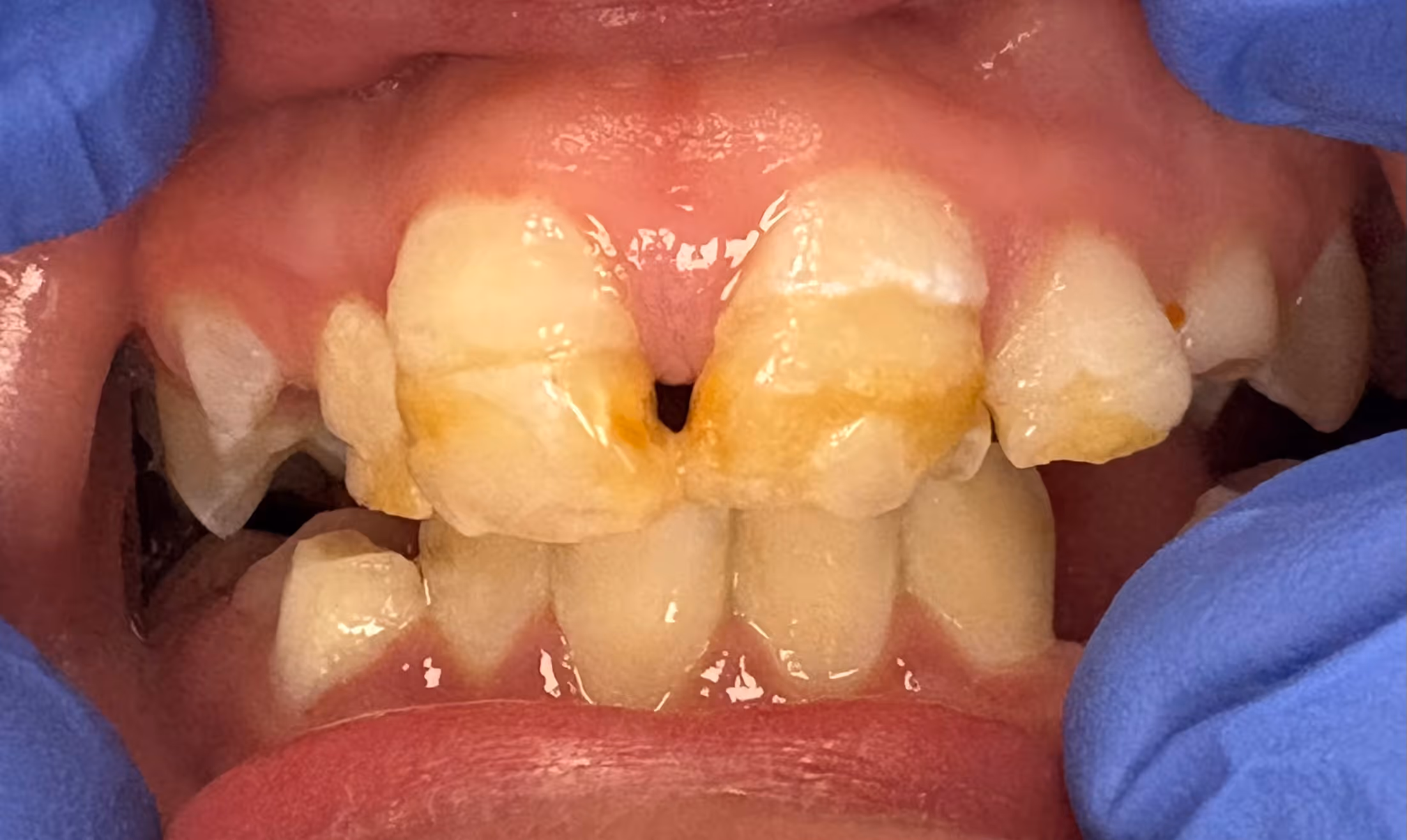 before and after treatment