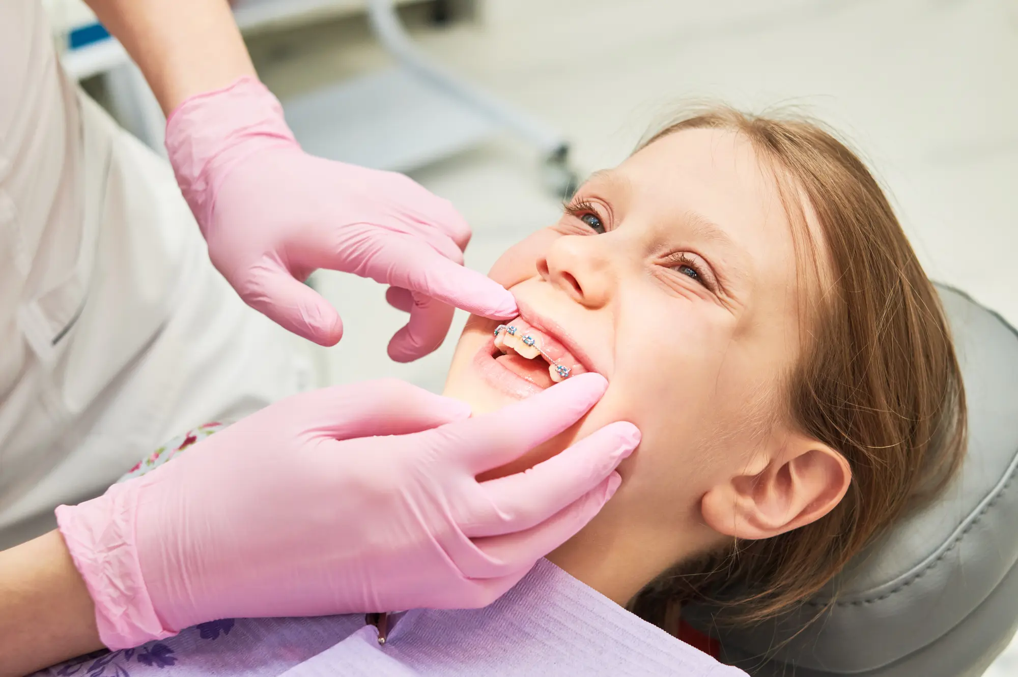 Braces Are Off - Now What? A Parent's Guide to Post-Orthodontic White Spots