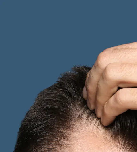 man running fingers through hair