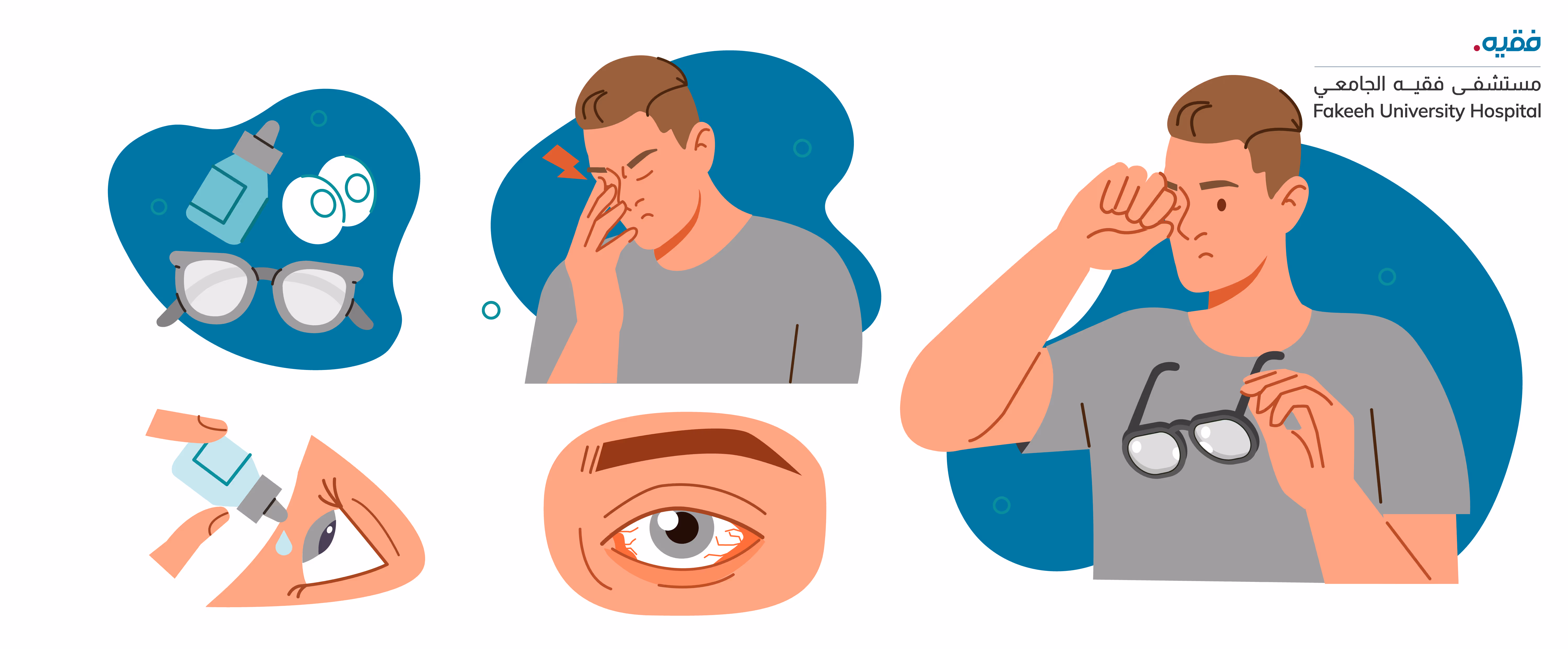 Image and illustration explaining dry eye disease cause and what is the dry eye syndrome