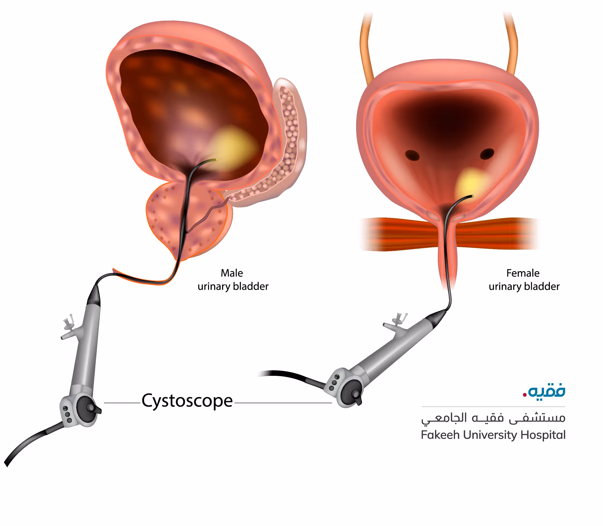 is a test that lets the healthcare provider view the urinary tract. This area includes the bladder, the urethra, and the openings to the ureters. 