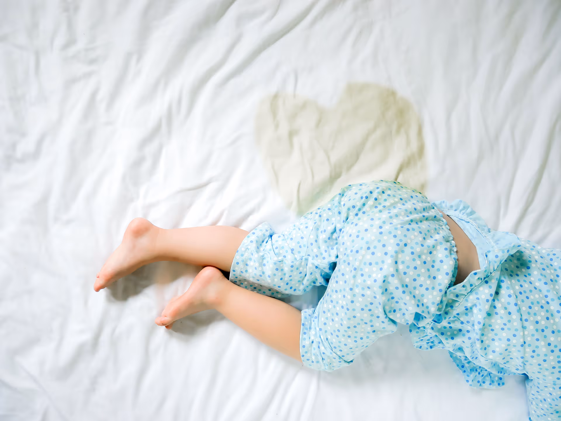 Bedwetting in Children