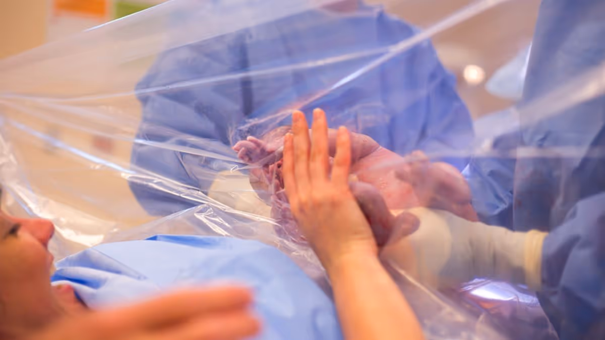 Gentle Cesarean Section: Redefining Birth with Compassion and Care