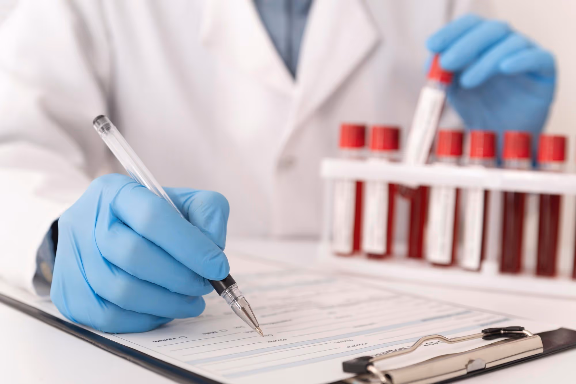 Routine blood tests to keep heart issues at bay