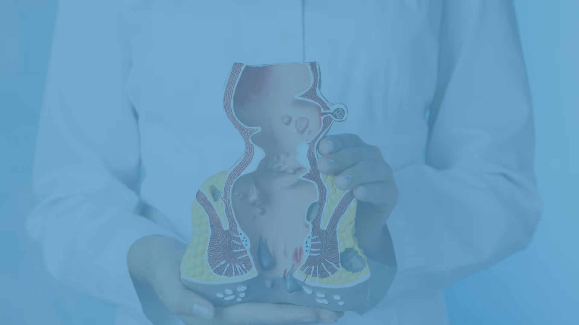 Hemorrhoids Treatment Dubai | Symptoms of hemorrhoids (Piles)