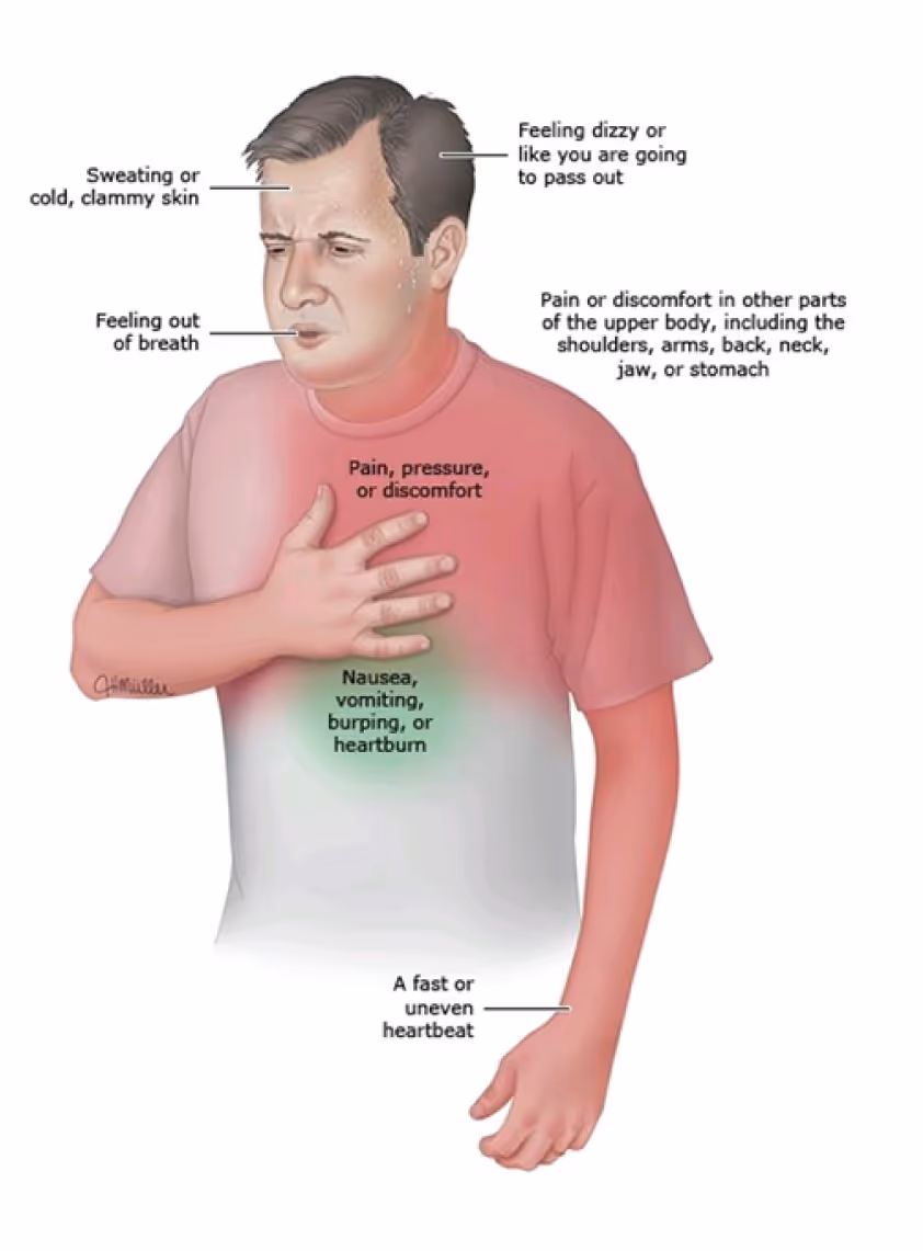 What is a Heart Attack Symptoms
