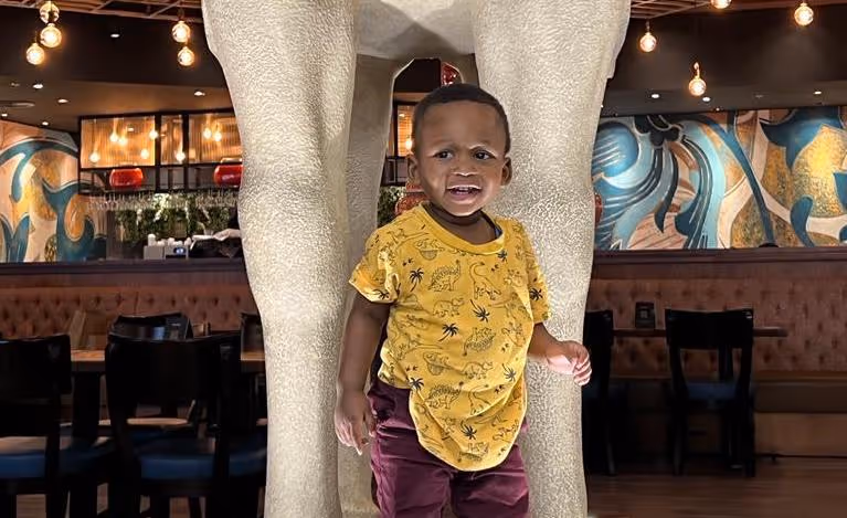 Pediatric Surgeon saves 18 month old baby's kidney