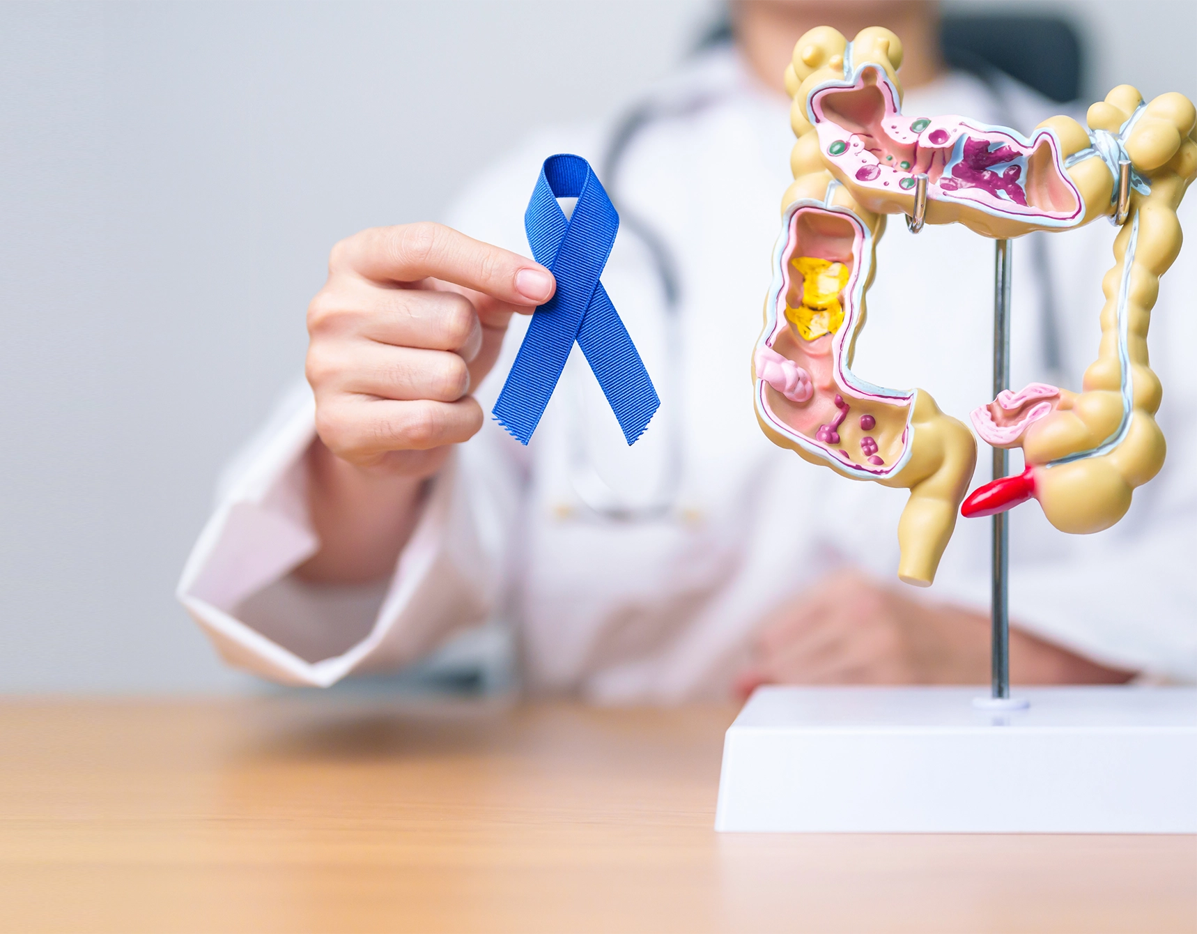 Free Colon Cancer Screening