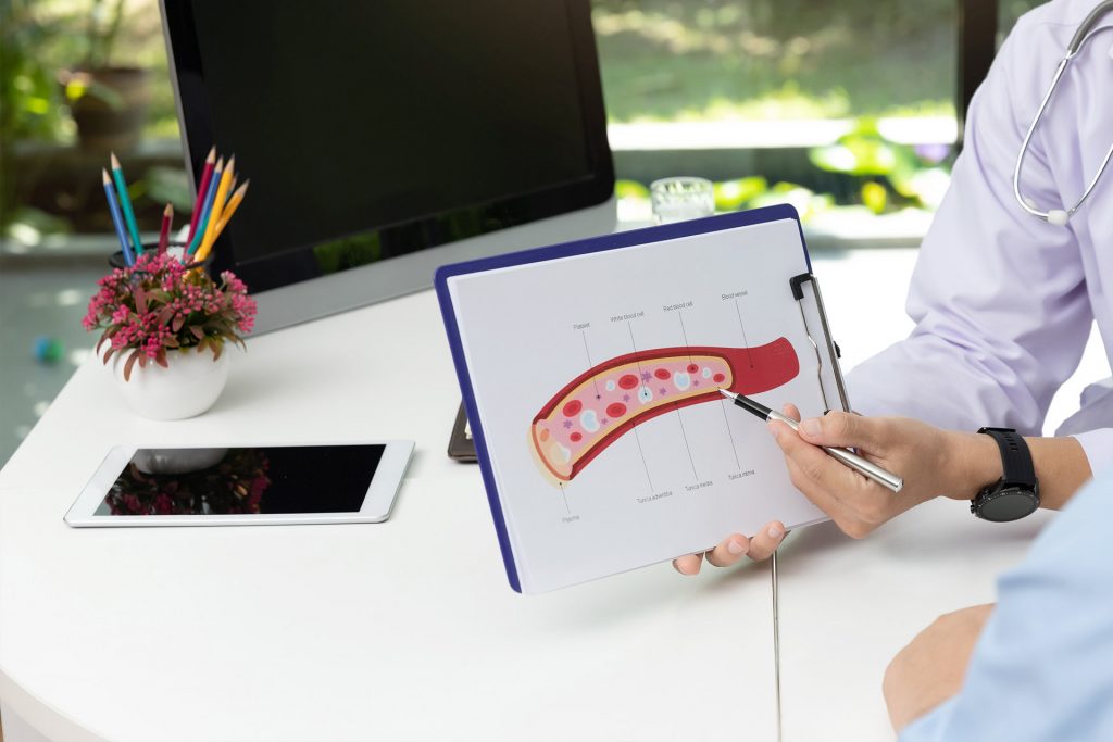 جراحة الأوعية الدموية