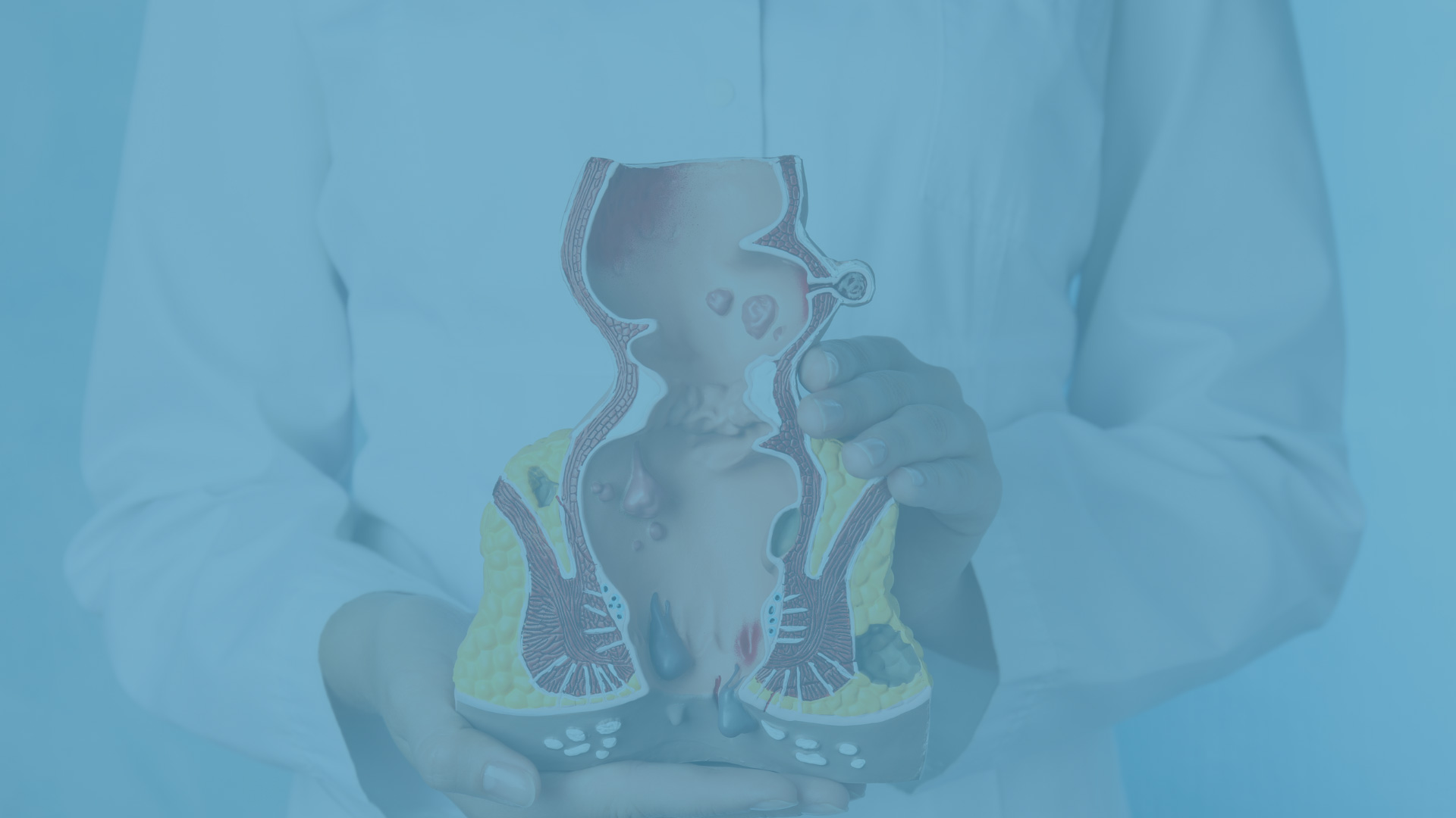 علاج البواسير في دبي