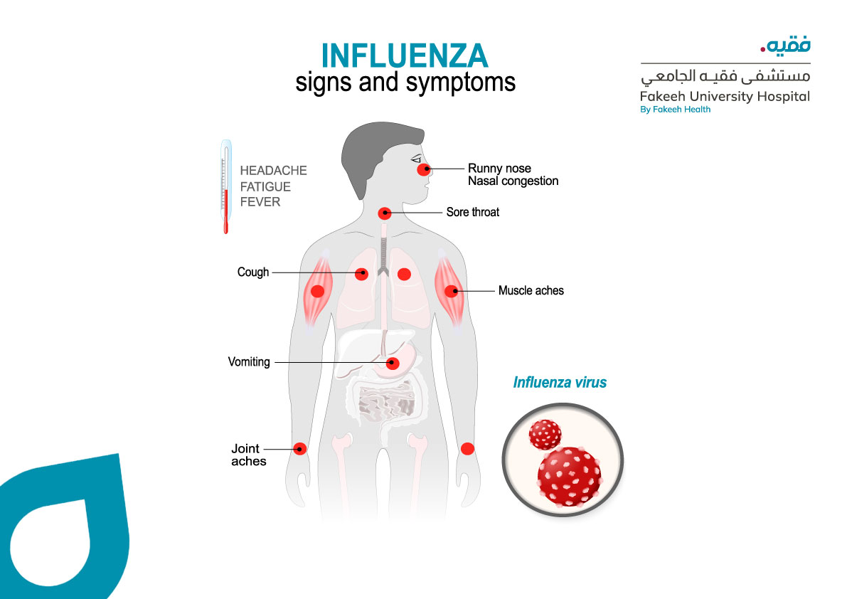 What Are the Symptoms of Influenza (FLU)?