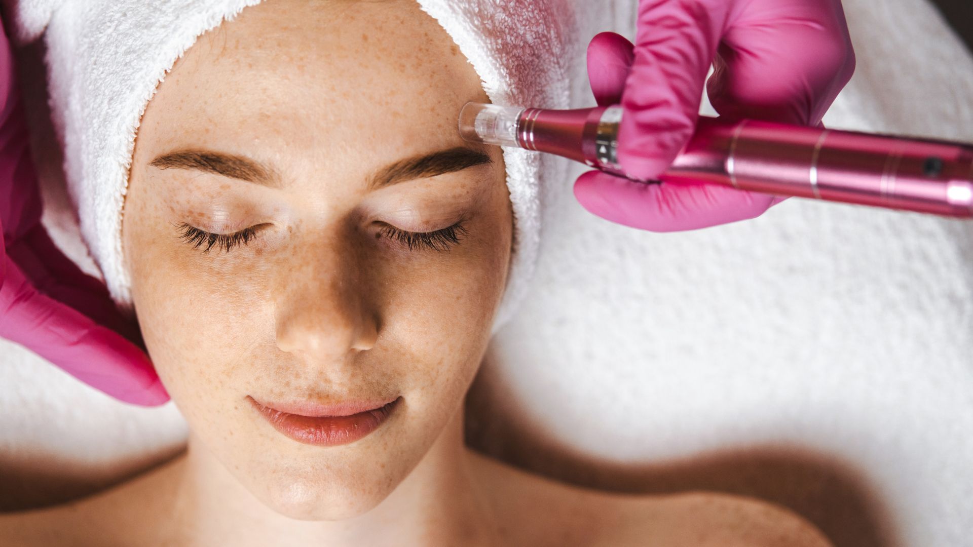 Psoriasis Treatment in Dubai