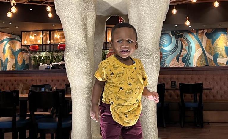 جراح أطفال ينقذ كلية طفل يبلغ من العمر 18 شهراً