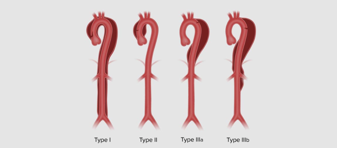 النجاة من القاتل الصامت: انتصار شاب يبلغ من العمر 34 عاماً على مرض قلبي مهدد للحياة