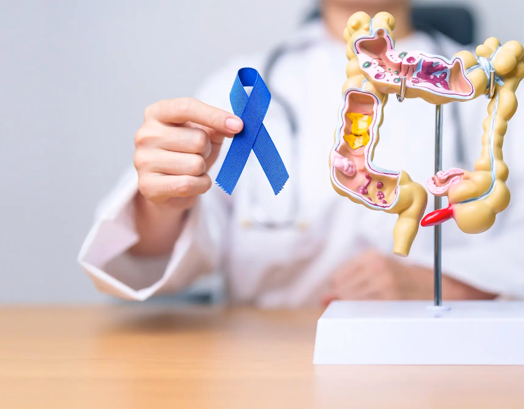 Colon Cancer Screening