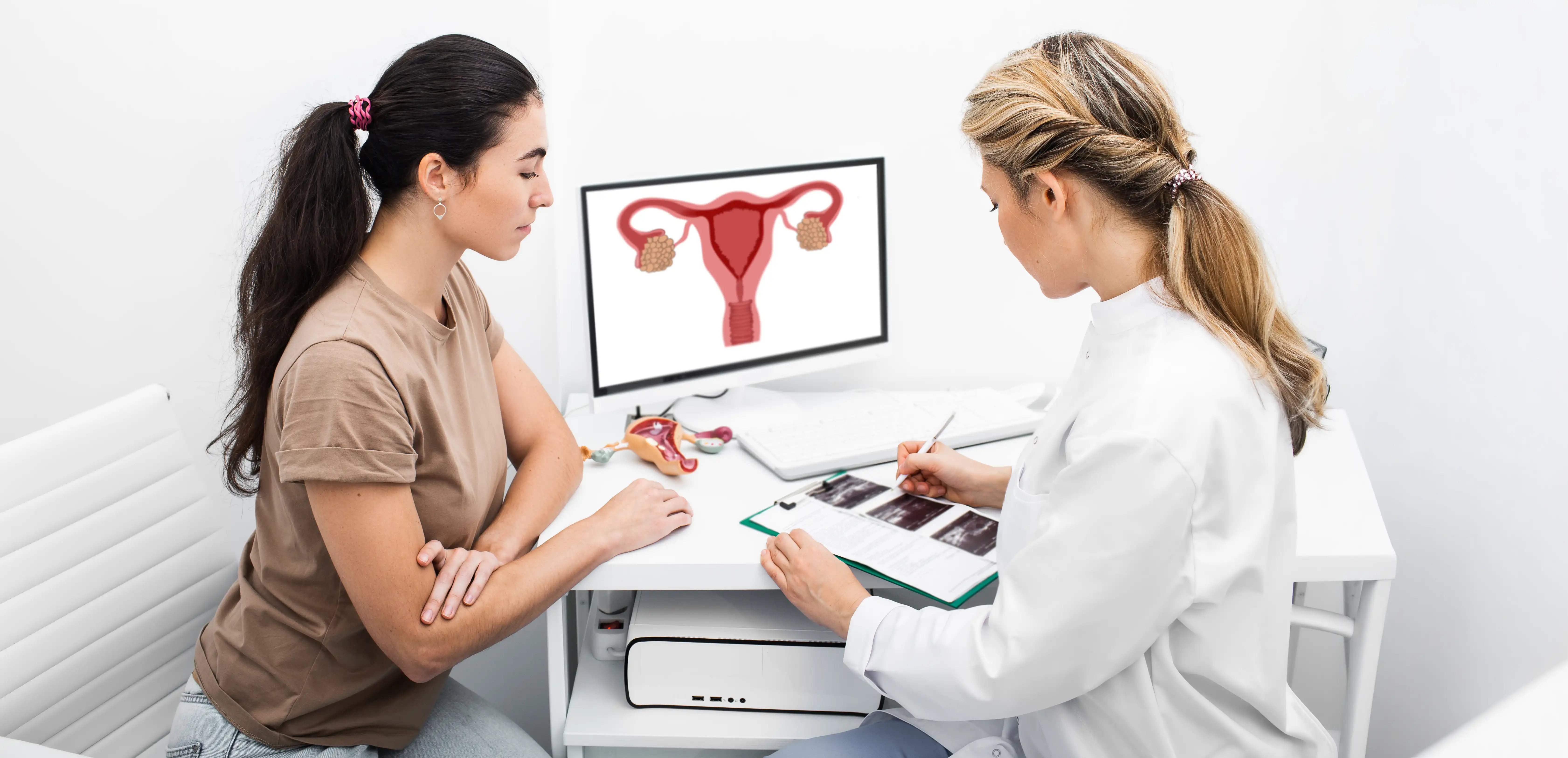 Uterine fibroids: a common gynecological problem