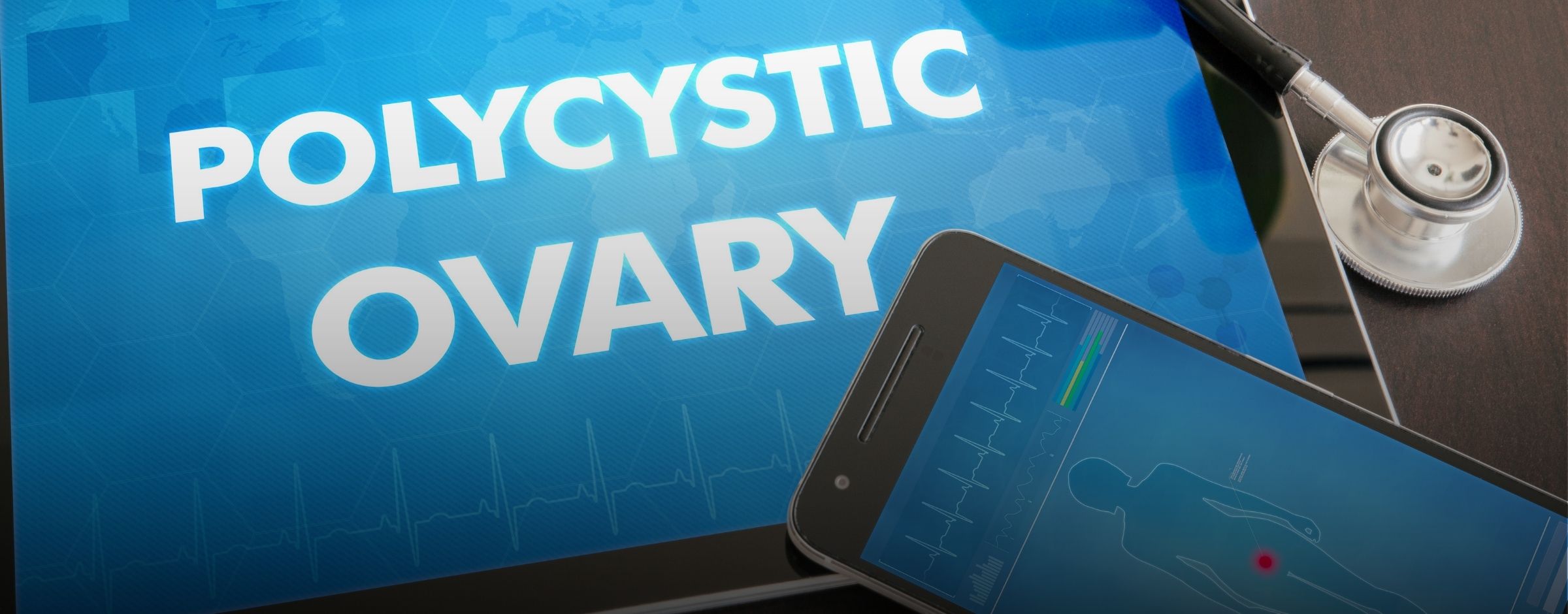 Comprehensive PCOS Treatment in Dubai (Polycystic Ovary Syndrome)