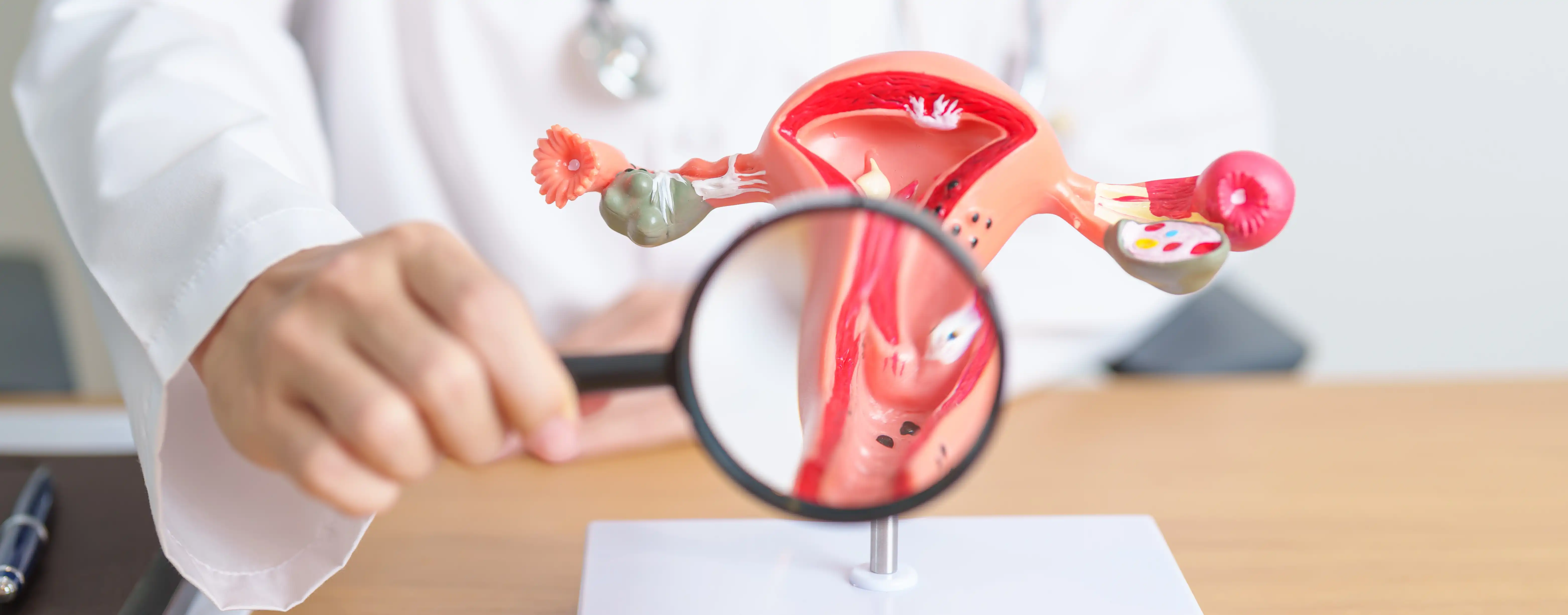 Hysterectomy: Surgical Removal of The Uterus