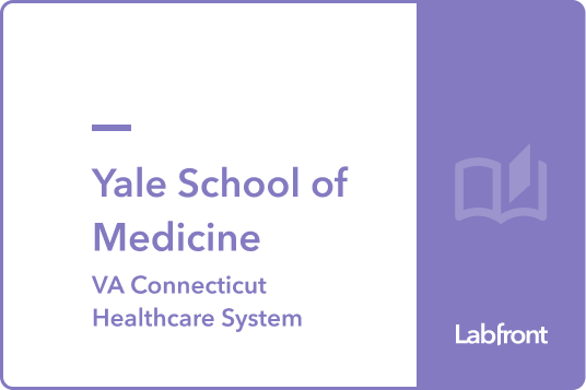 MOVE-CGM: Personalized Exercise Coaching for Adults with Type 1 Diabetes