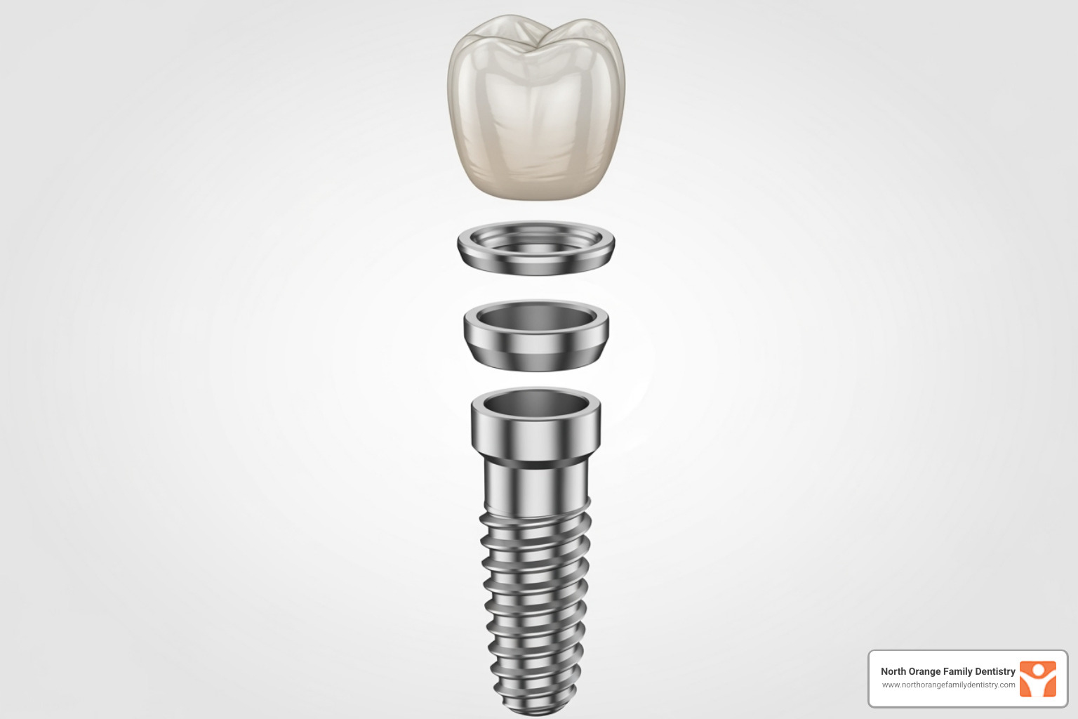 A detailed diagram showing the three main components of a dental implant: the screw-like implant post, the connecting abutment, and the tooth-shaped crown. - how much do dental implants cost without insurance