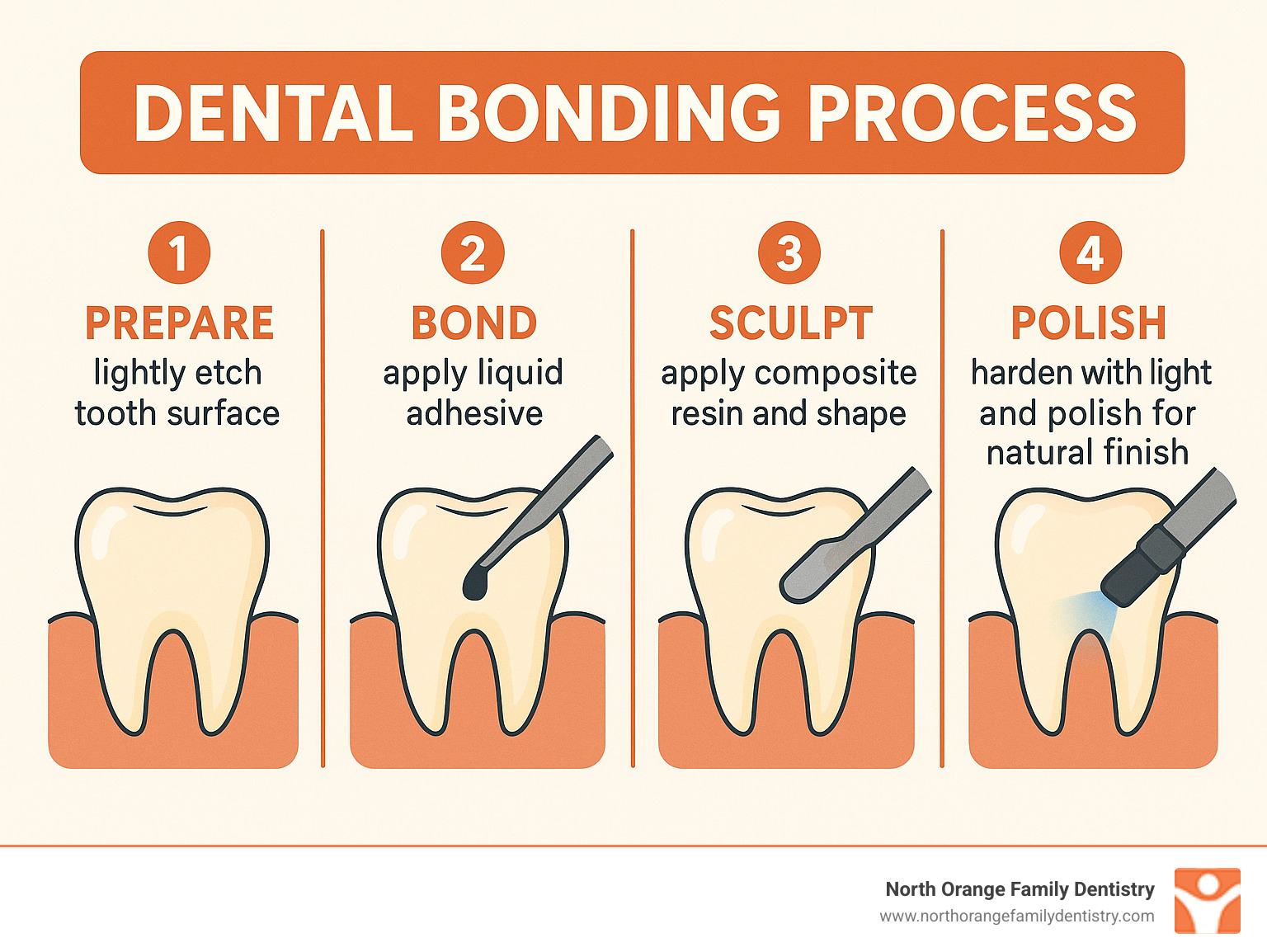 Infographic detailing the 4-step dental bonding process: 1. Prepare (lightly etch tooth surface), 2. Bond (apply liquid adhesive), 3. Sculpt (apply composite resin and shape), 4. Polish (harden with light and polish for natural finish) - dental bonding before after infographic 