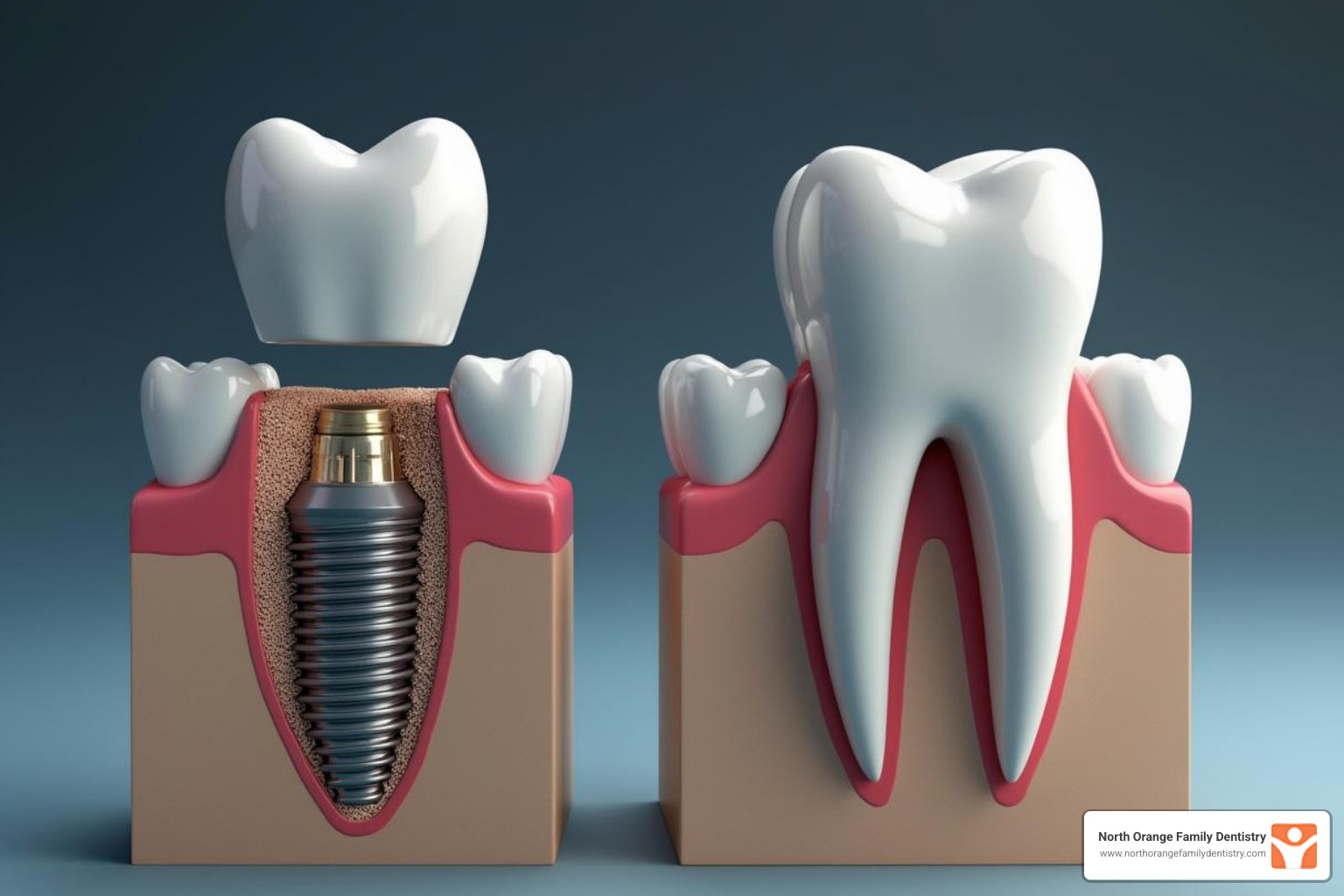 Comparison of dental implants vs. traditional bridges - dental implants cost