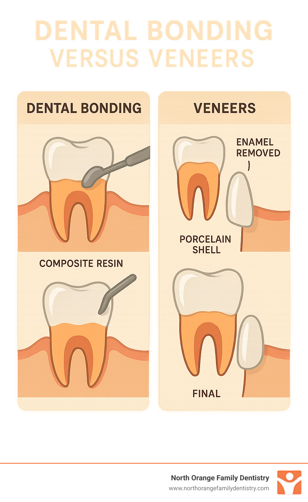 Detailed comparison infographic showing dental bonding application with composite resin on one side and veneer placement with porcelain shell on the other side, including cross-sectional views of tooth preparation, materials used, and final results - dental bonding versus veneers infographic 