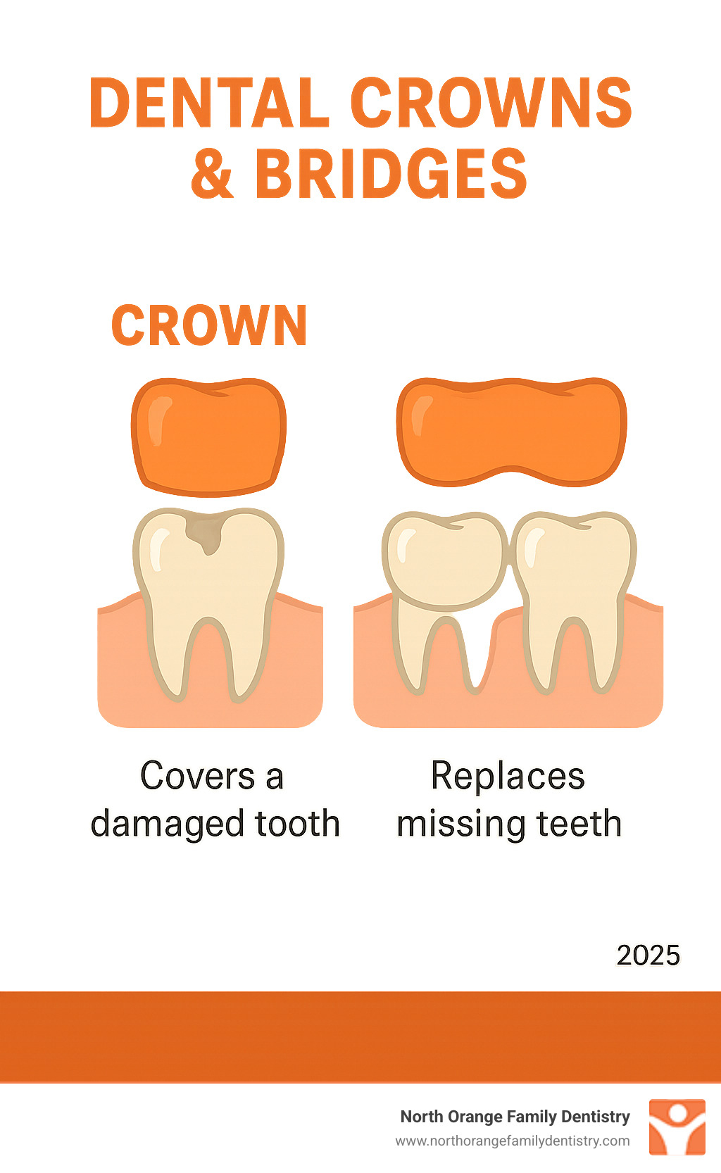 Infographic showing the visual difference between a dental crown covering a single damaged tooth and a dental bridge spanning across multiple teeth to replace missing ones, with labels indicating crown placement over existing tooth structure versus bridge attachment to adjacent healthy teeth - dental crowns and bridges near me infographic 