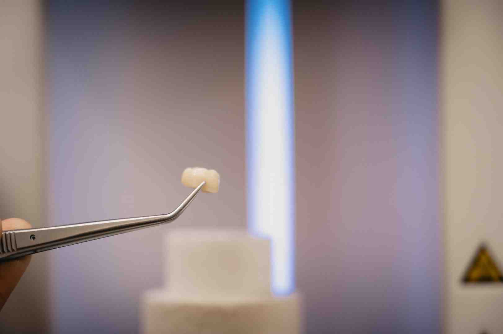 Demystifying Resin Bonded Bridge Costs: Your Informational Guide