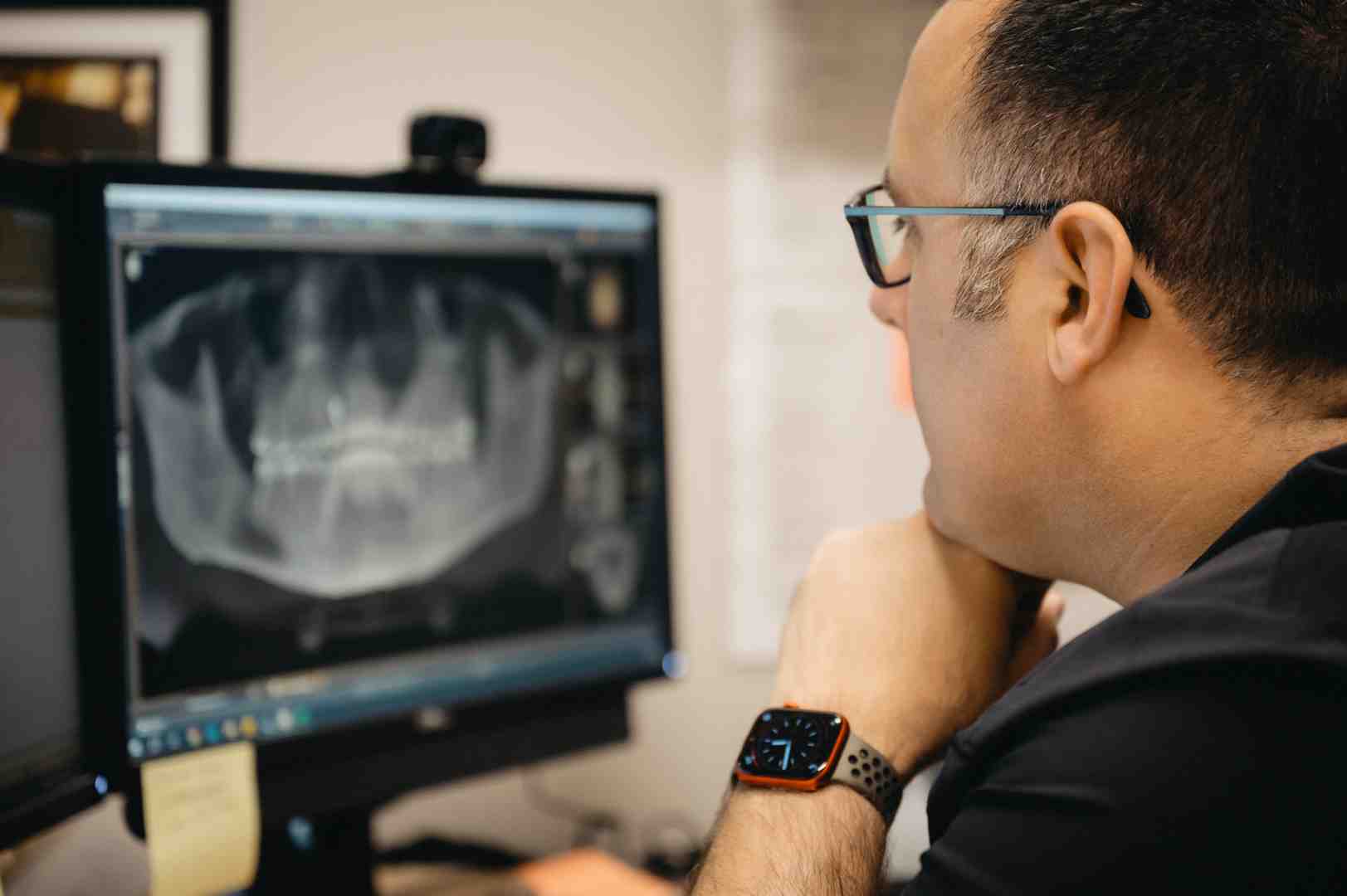 dental x-ray showing a tooth needing a root canal - how much are cosmetic canine tooth crowns