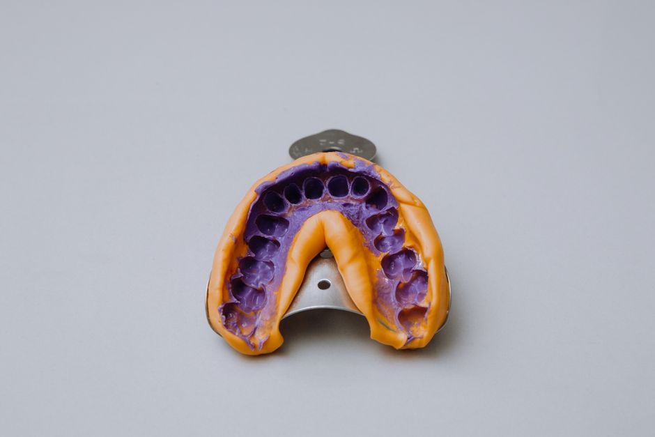 Custom Trays for Gingivitis: Give Your Gums the VIP Treatment