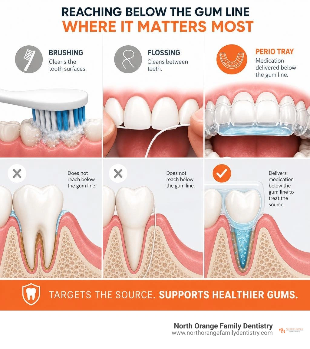 Infographic comparing brushing and flossing with Perio Tray medication delivery below gums infographic