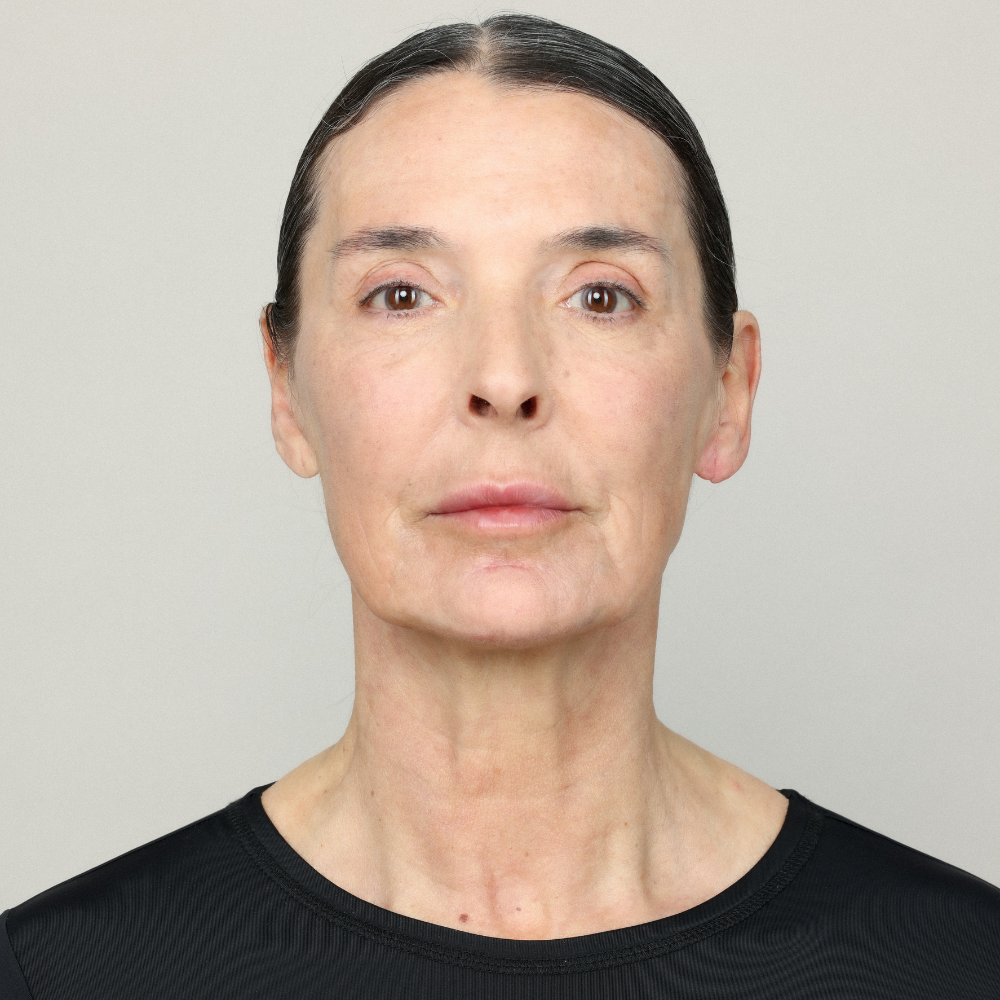 Genefill dermal filler treatment area