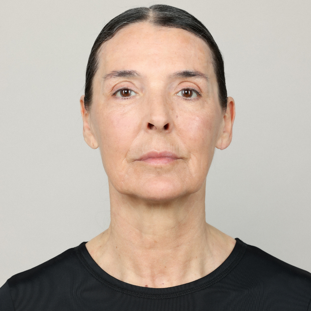 Natural face contouring results with Genefill biphasic hyaluronic acid fillers