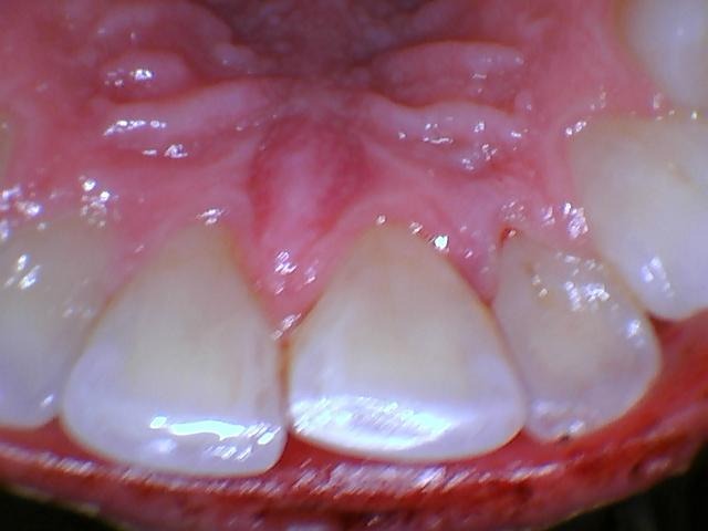 Strahler Dental appointment