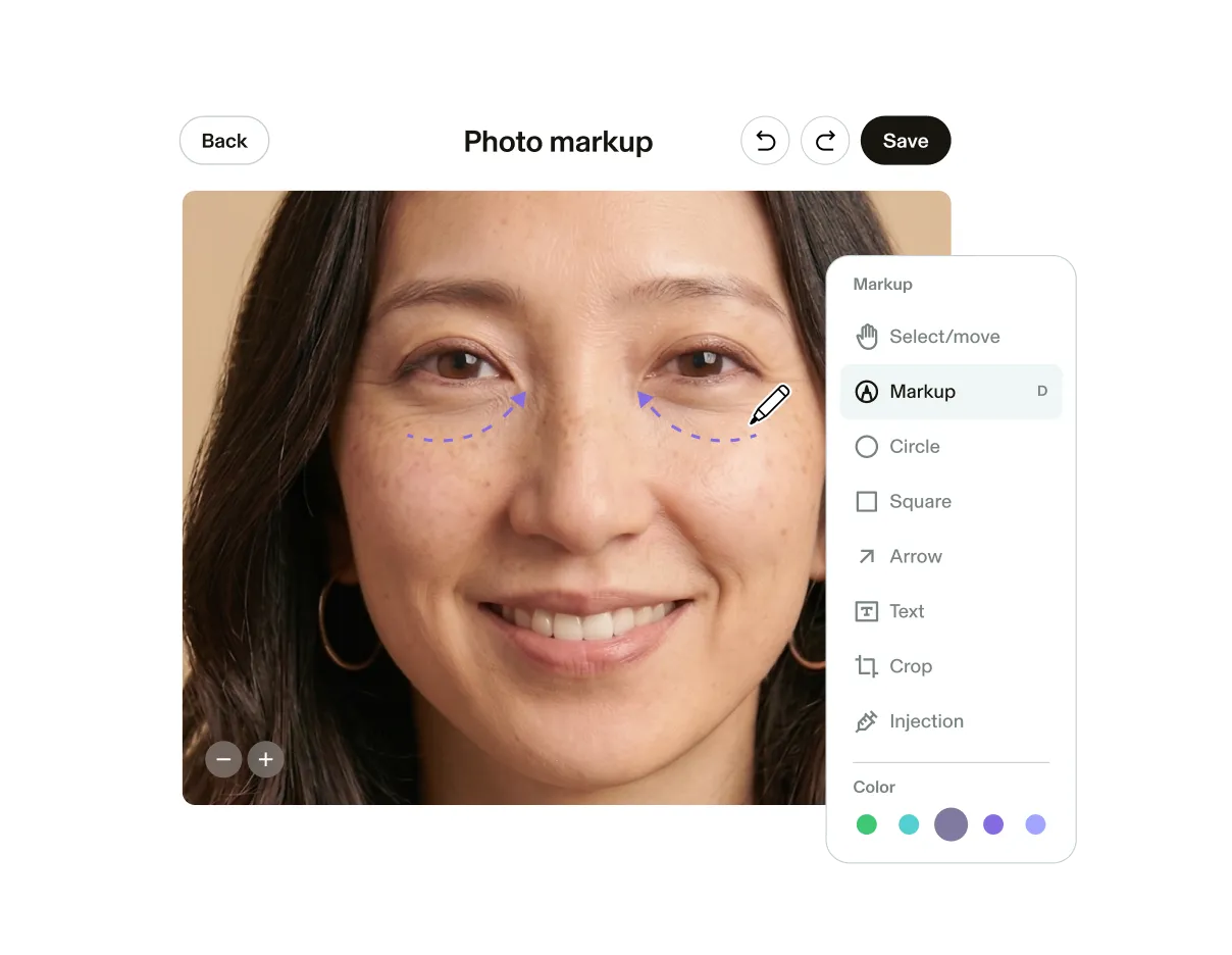Photo example of GlossGenius’s Photo Markup tool showing a client’s undereyes marked where they received treatment plus a menu of options for photo markup like cropping, text insert, or shapes