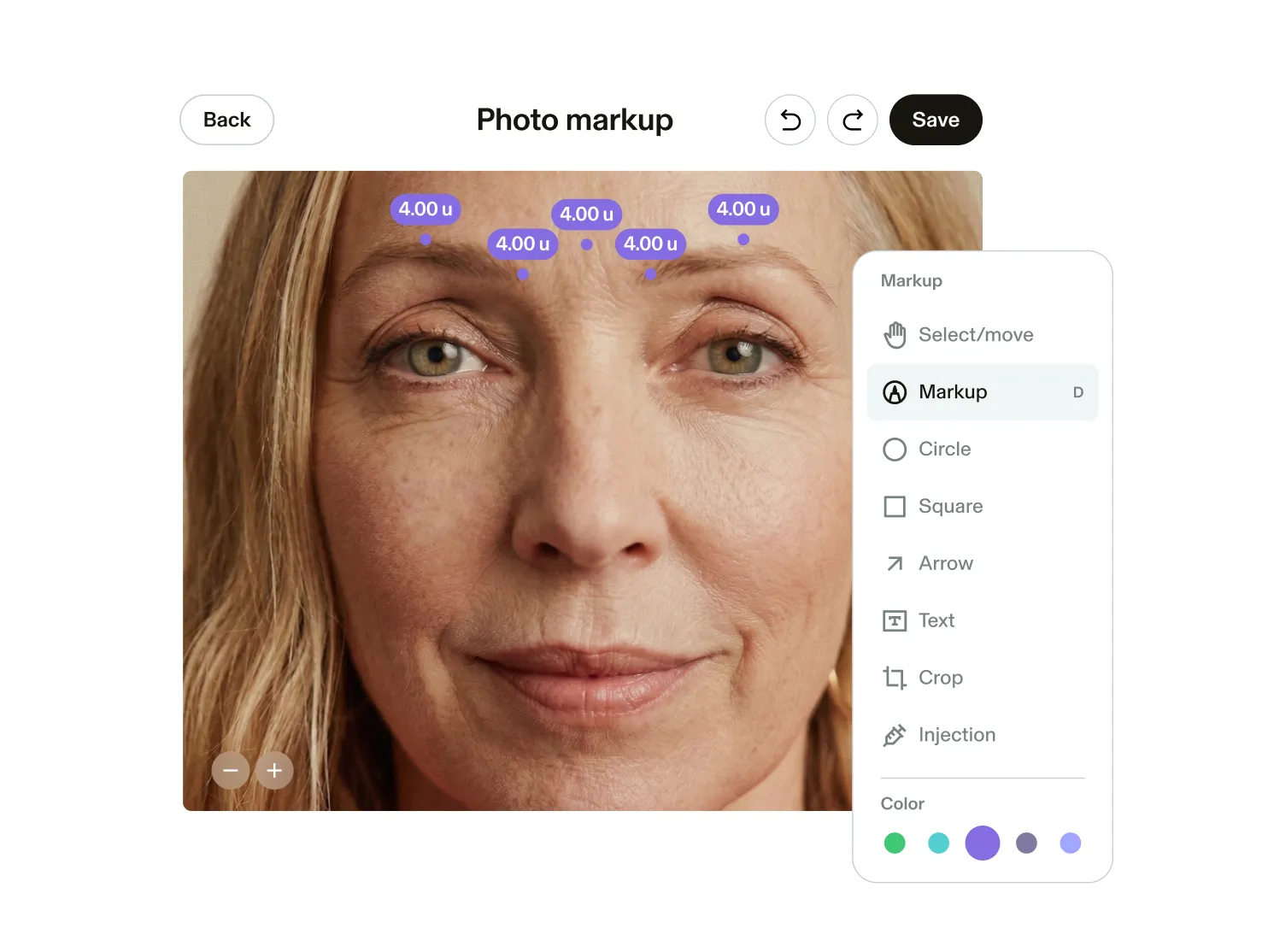 Photo example of GlossGenius’s Photo Markup tool showing a client’s lips marked where they received treatment plus a menu of options for photo markup like cropping, text insert, or shapes