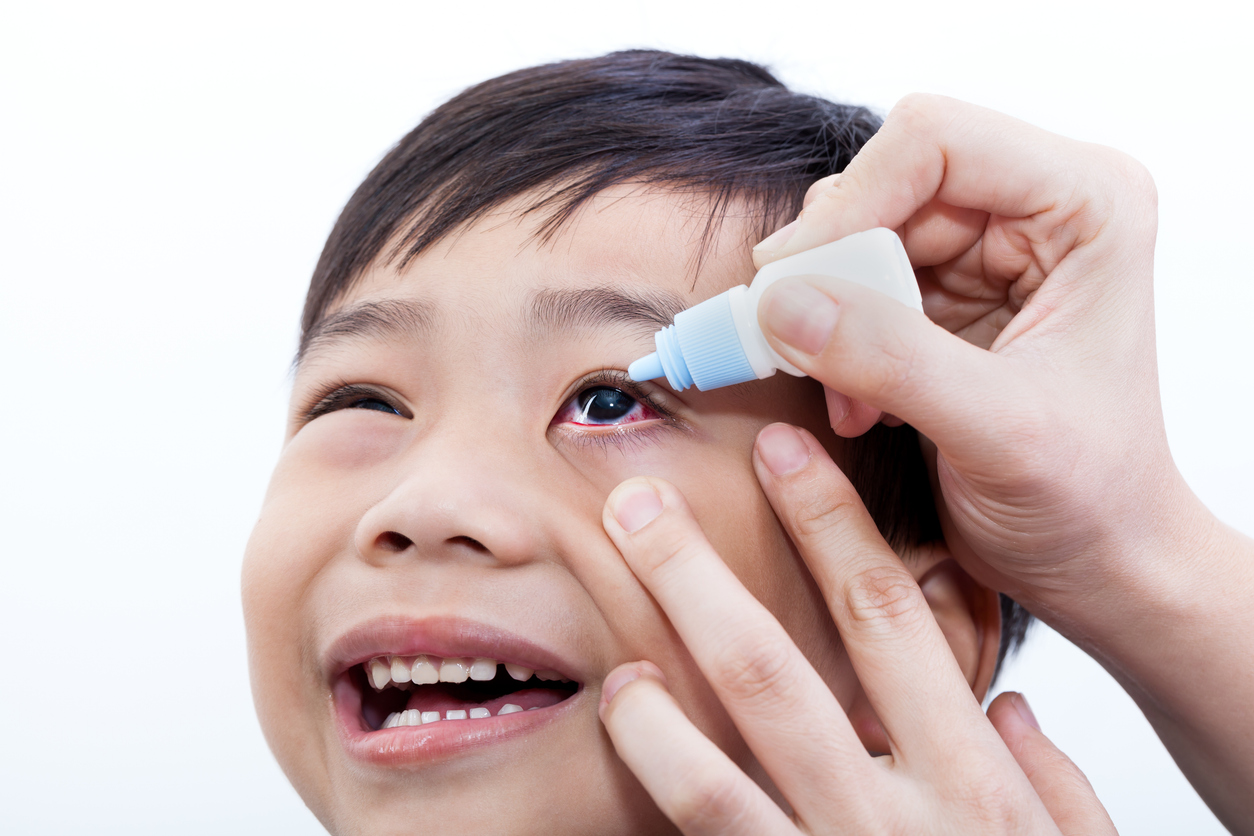 A little boy with red eyes waits as drops are put into his eyes from an eye drop bottle. 