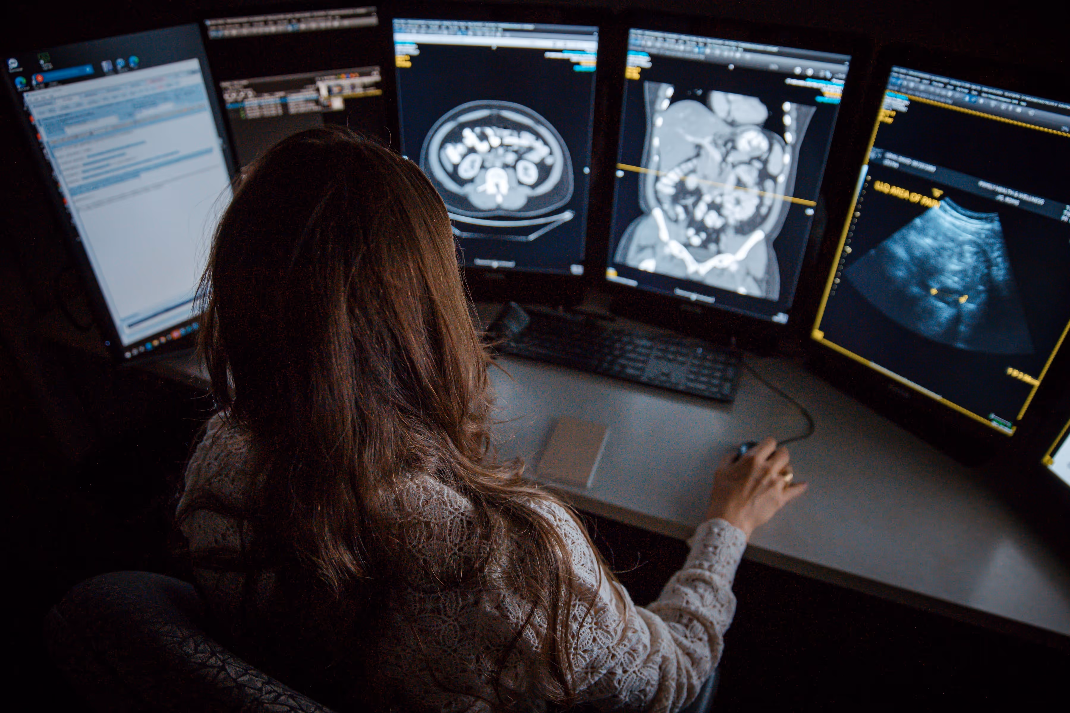 Person analyzing medical scans and ultrasound images on multiple monitors in a dimly lit room.