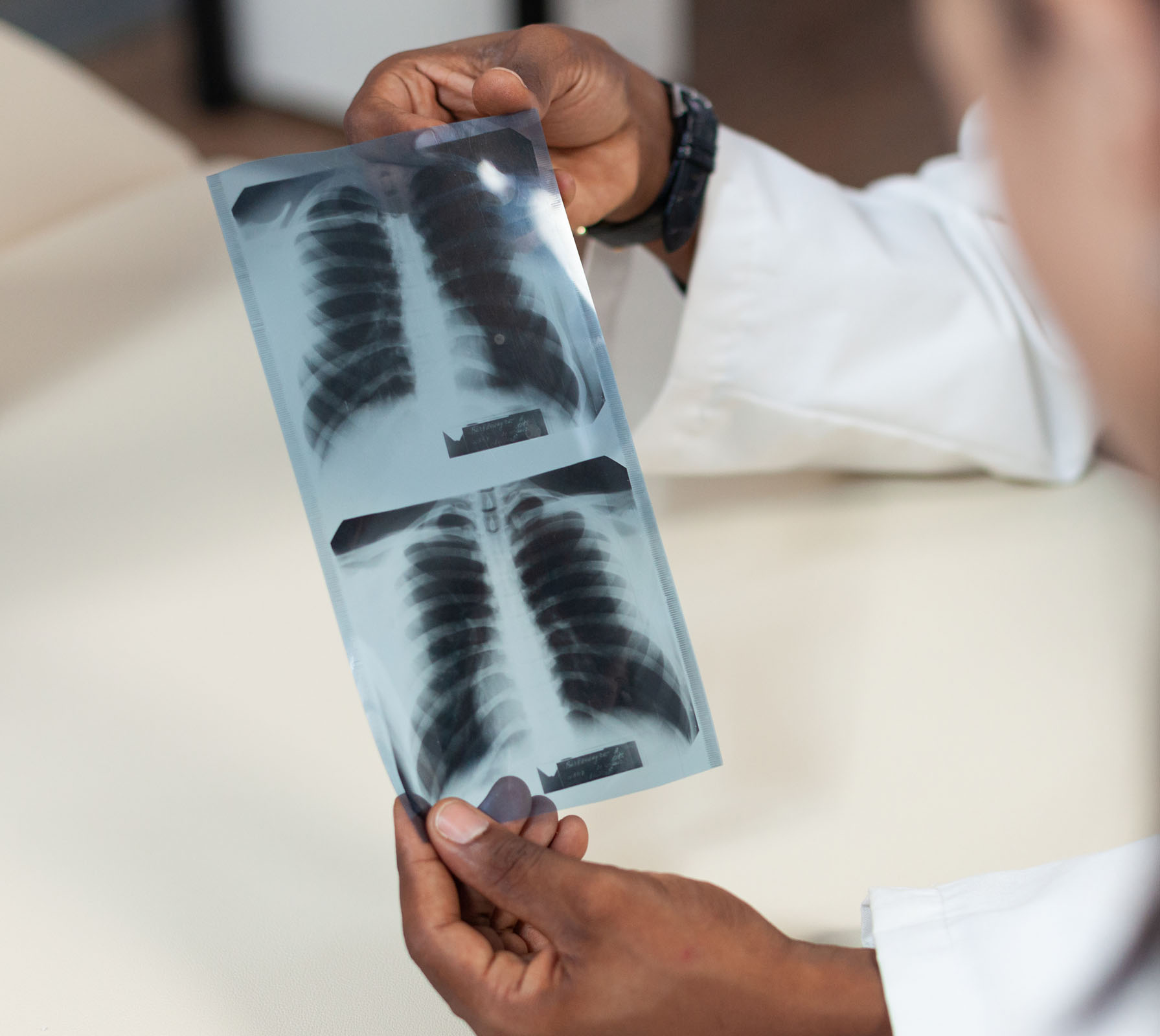 A physician holding up a chest X-ray film to review it.
