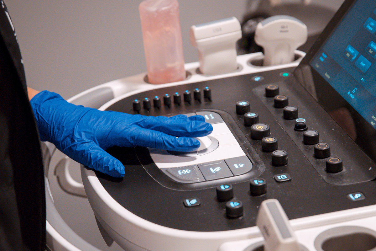 A gloved hand operating the control panel of an ultrasound machine.