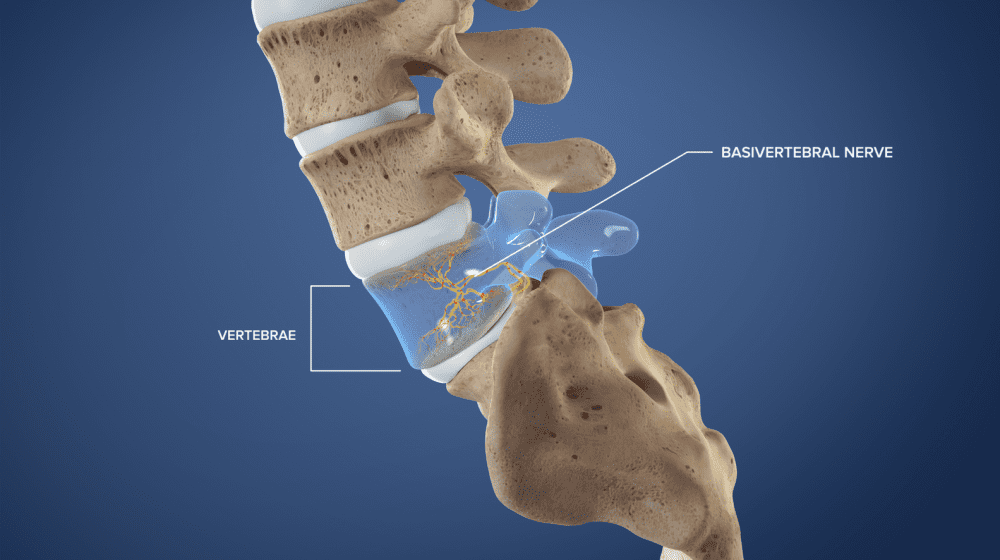 Medical illustration of vertebrae with the basivertebral nerve labeled.