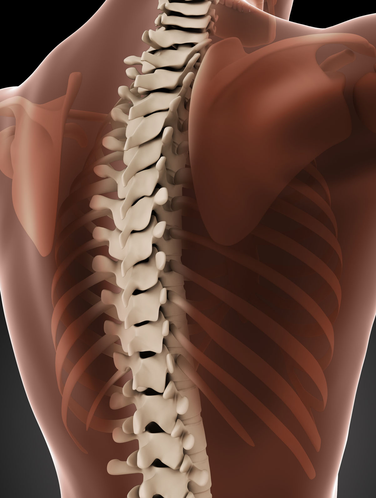 Medical illustration of the spine viewed from the side, showing the vertebrae and surrounding muscle.