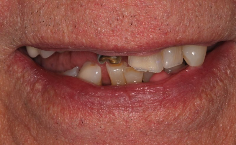 before and after treatment