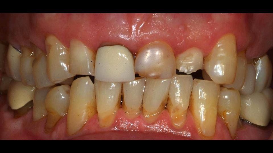 before and after treatment
