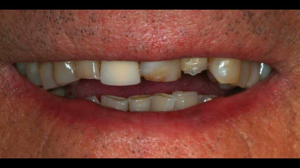 before and after treatment