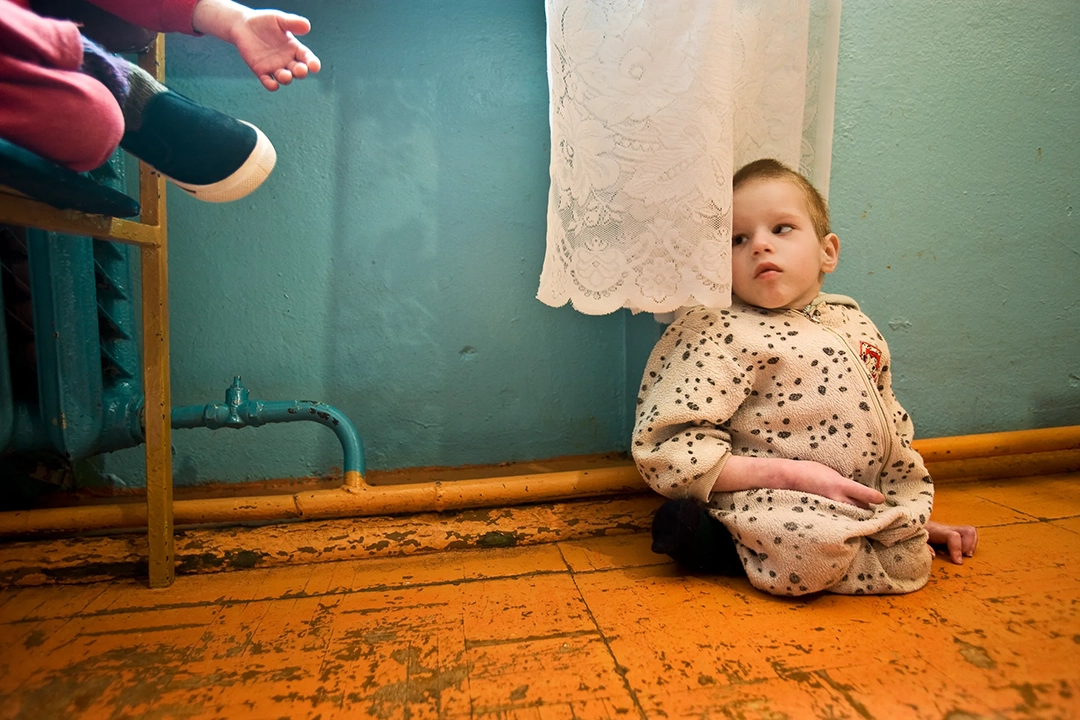 Igor, aged five in 2005, was born severely disabled and cared for at an orphange in southern Belarus. © Gerd Ludwig, 1993