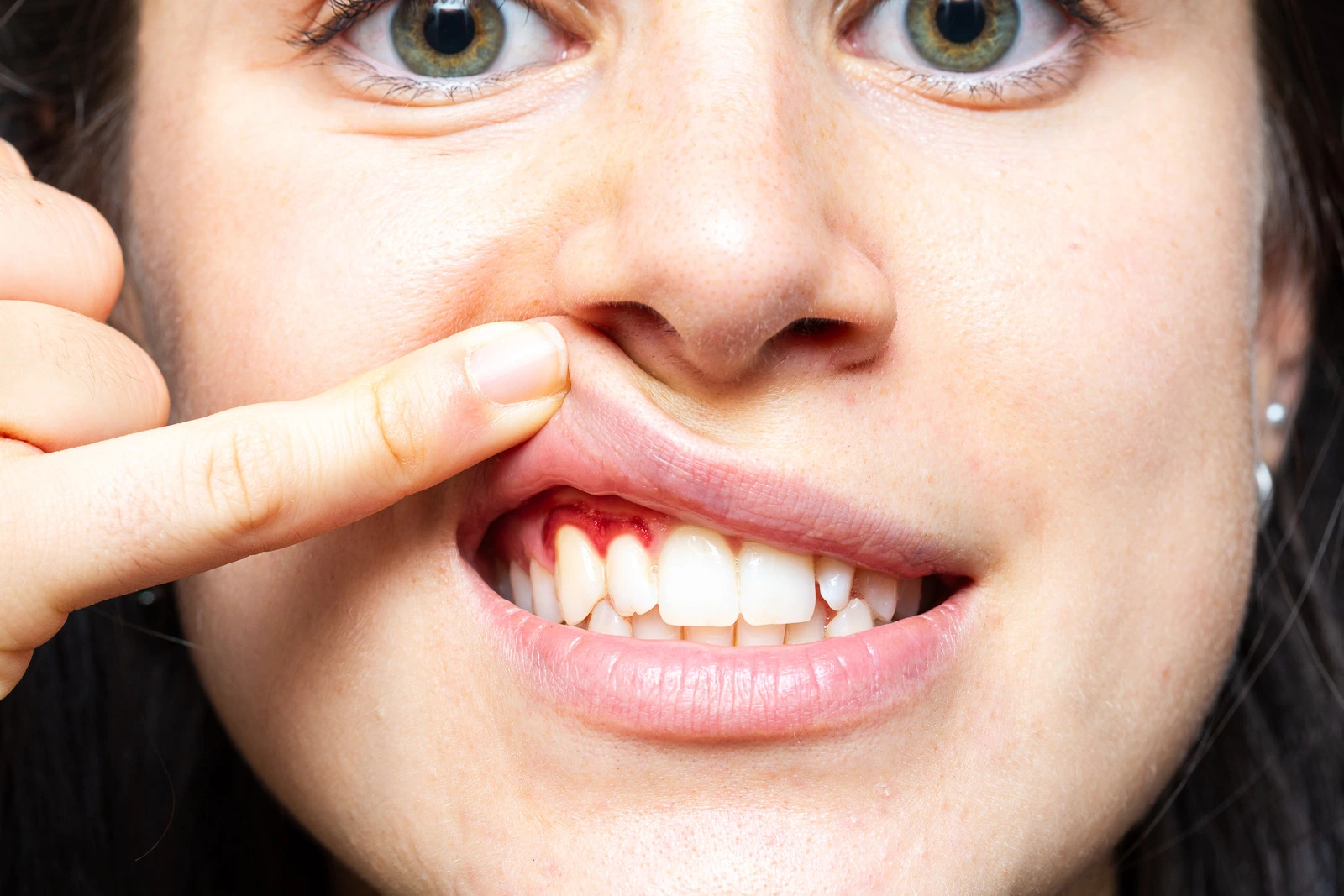 Person examining their gums in a bathroom mirror after brushing their teeth